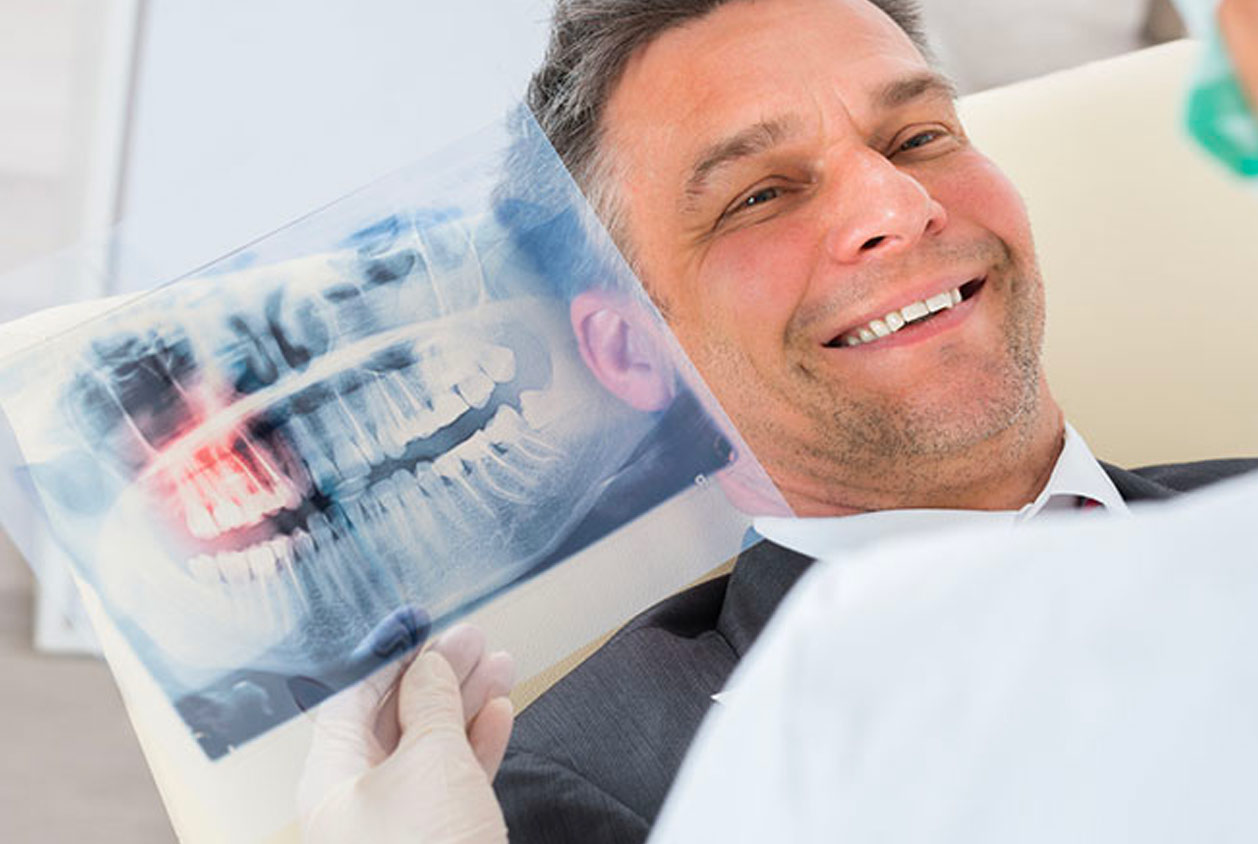Studio Dentistico Labaro | News Implantologia a carico immediato dentale